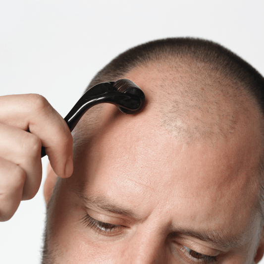 Dermarolling: De Perfecte Winterboost voor Je Huid